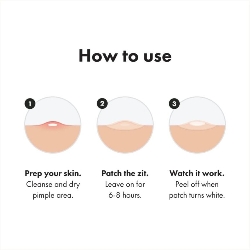 Mighty patch original patch from hero cosmetics hydrocolloid acne pimple patch for covering zits and blemishes in face a 1