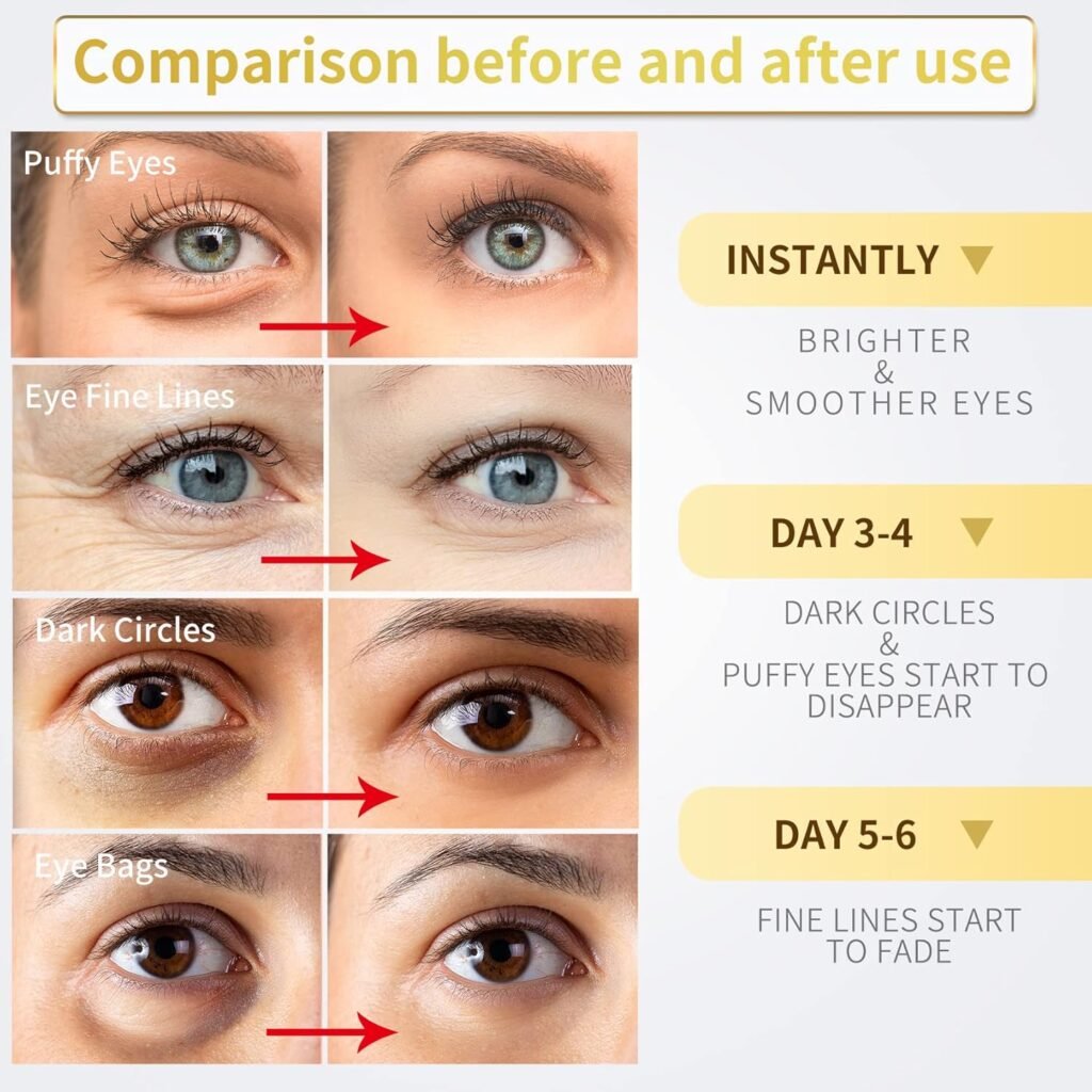 Under Eye Patches - 60 Pcs - 24K Gold Eye Mask- Puffy Eyes  Dark Circles Treatments,Reduce Under Eye Bags and Smooth Wrinkles,Eye Skin Care Pads With Collagen,Hyaluronic Acid  Castor Oil
